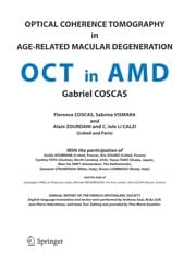 Tapa de Optical Coherence Tomography in Age-Related Macular Degeneration