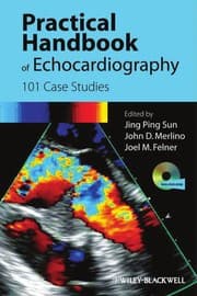 Tapa de Practical handbook of echocardiography