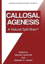Tapa de Callosal Agenesis