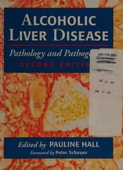 Tapa de Alcoholic Liver Disease