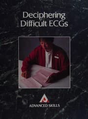 Tapa de Deciphering difficult ECGs