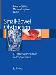 Tapa de Small-Bowel Obstruction