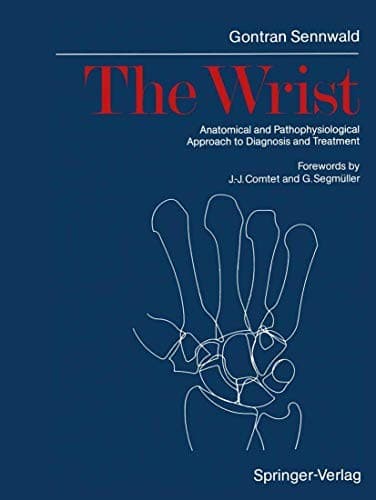 Tapa de The Wrist