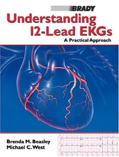 Tapa de Understanding 12-lead EKGs