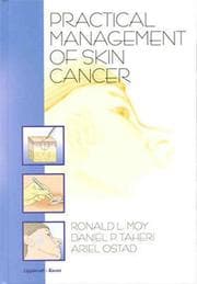 Tapa de Practical management of skin cancer