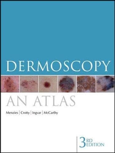 Tapa de Dermoscopy