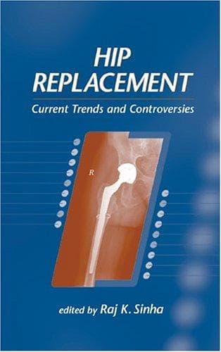 Tapa de Hip Replacement
