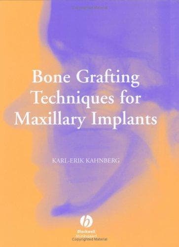 Tapa de Bone grafting techniques for maxillary implants