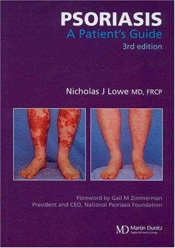 Tapa de Psoriasis