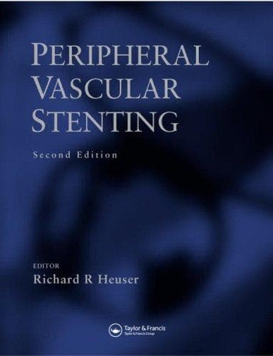 Tapa de Peripheral Vascular Stenting
