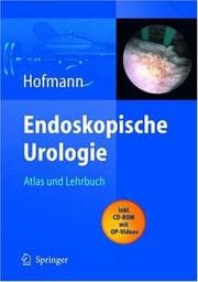 Tapa de Endoskopische Urologie