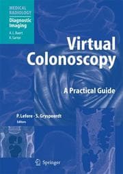 Tapa de Virtual colonoscopy
