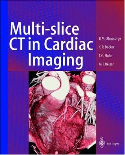 Tapa de Multi-slice CT in cardiac imaging
