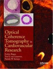 Tapa de Optical coherence tomography in cardiovascular research