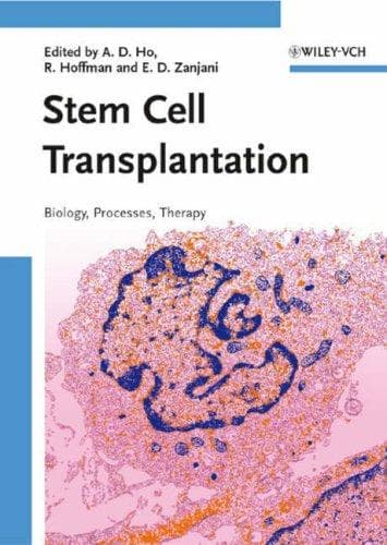 Tapa de Stem cell transplantation