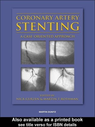 Tapa de Coronary Artery Stenting