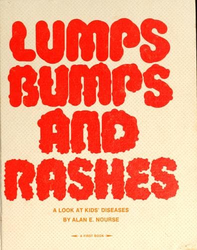 Tapa de Lumps, bumps, and rashes