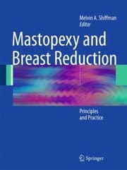 Tapa de Mastopexy And Breast Reduction Principles And Practice