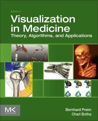 Tapa de Visual Computing For Medicine Theory Algorithms And Applications