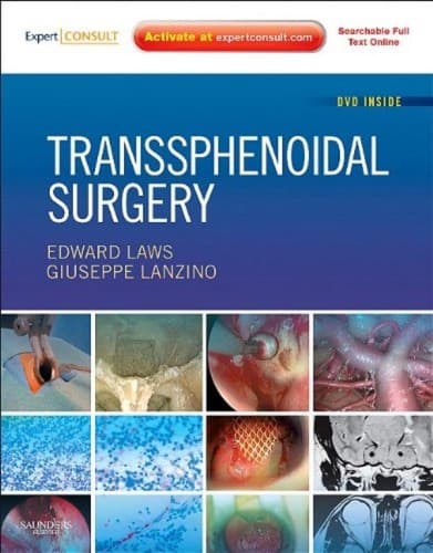 Tapa de Transsphenoidal surgery
