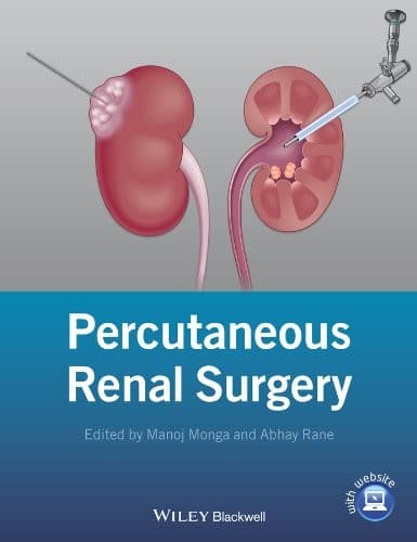 Tapa de Percutaneous Renal Surgery