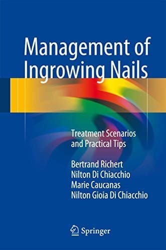 Tapa de Management of Ingrowing Nails