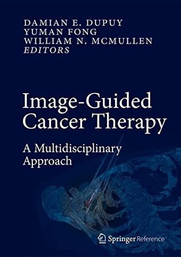 Tapa de Image-Guided Cancer Therapy