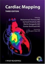 Tapa de Cardiac mapping