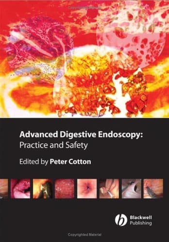 Tapa de Advanced digestive endoscopy